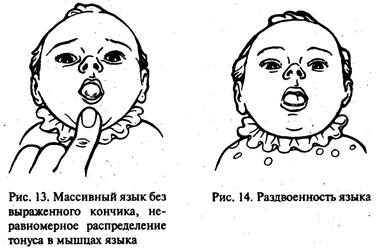 Четыре уровня доречевого развития детей с ДЦП - student2.ru