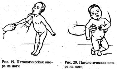 Четыре уровня доречевого развития детей с ДЦП - student2.ru