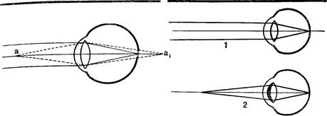 дальнозоркость и близорукость - student2.ru