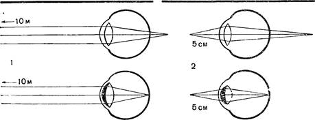 дальнозоркость и близорукость - student2.ru