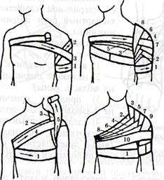 десмургия. мягкие и твердые повязки - student2.ru
