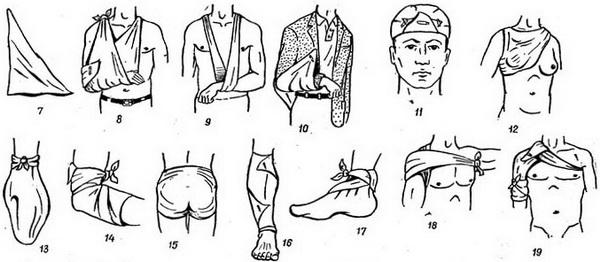 Десмургия. Правила наложения повязок - student2.ru