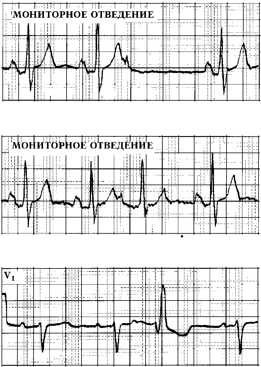 Диагностика, дифференциальная диагностика - student2.ru