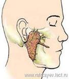 Диагностика опухолей слюнных желез - student2.ru