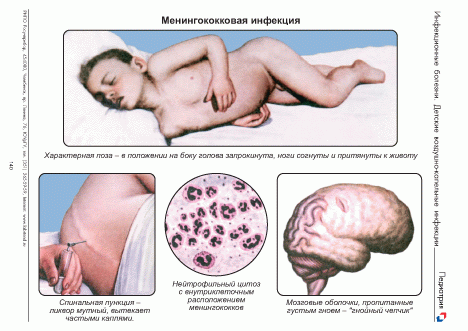 Диагностика. При инфекции С. Pneumoniae чаще всего используются серологические методы диагностики. - student2.ru