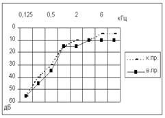 Диагностика сенсоневральной тугоухости - student2.ru