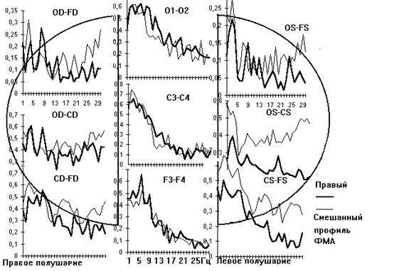 Динамика ЭЭГ показателей симметричных зон коры головного мозга человека в процессе интеллектуальной деятельности. - student2.ru