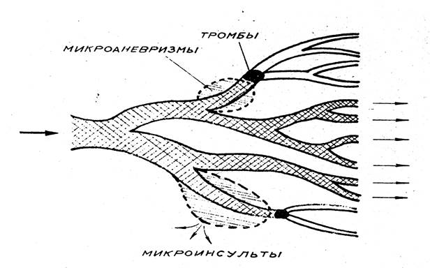 Длиннофокусные микроскопы, капилляры и алкогольная гипоксия - student2.ru