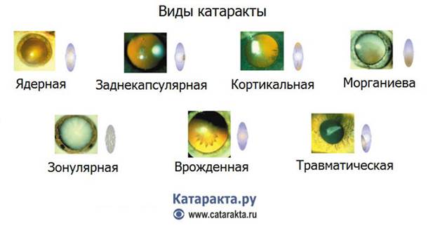 Домашние процедуры в постоперационный период - student2.ru