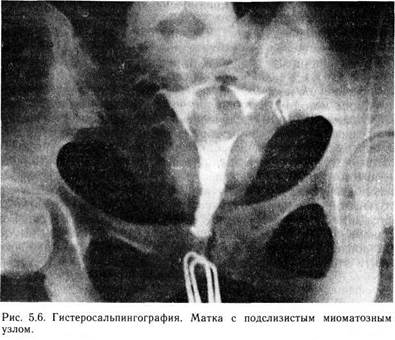 дополнительные методы исследования - student2.ru