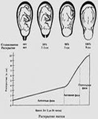 EПеринеотомия. Эпизиотомия - student2.ru