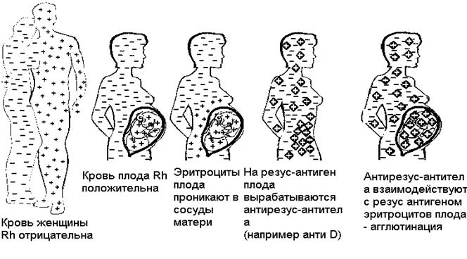 Если мембрана эритроцитов человека не содержит ни одного антигена этой системы, то его кровь считается резус-отрицательной. - student2.ru