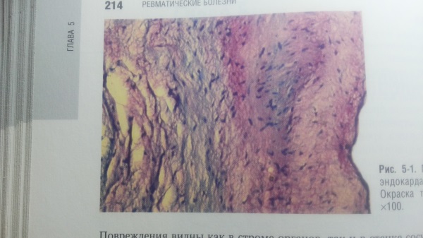 V1:Общая патологическая анатомия. - student2.ru