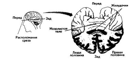 Функциональная асимметрия мозга - student2.ru
