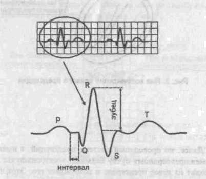 Функциональная диагностика сердечной деятельности. - student2.ru