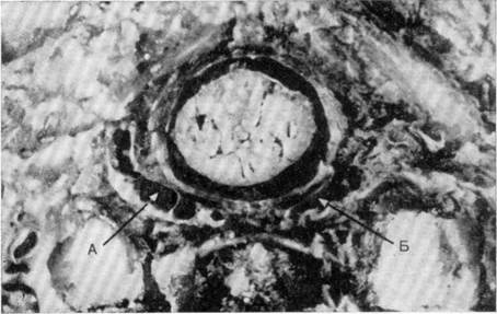 г. вены и венозные внутренние сплетения позвоночника - student2.ru