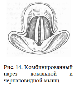 Гипотонусные нарушения голоса - student2.ru