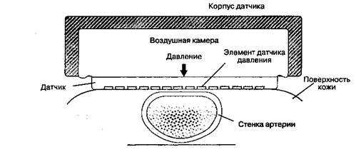 Глава 6 Интраоперационный мониторинг - student2.ru