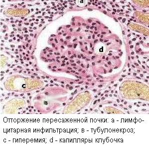 Гранулёматозная гиперчувствительность - student2.ru