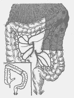 и нисходящей ободочной кишки - student2.ru