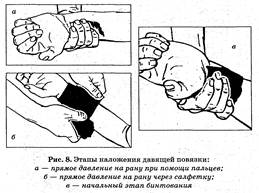 I. Поэтому первым (и главным) принципом оказания первой помощи при ранениях является остановка кровотечения любым доступным на данный момент способом - student2.ru