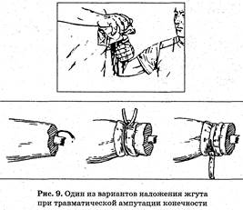 I. Поэтому первым (и главным) принципом оказания первой помощи при ранениях является остановка кровотечения любым доступным на данный момент способом - student2.ru