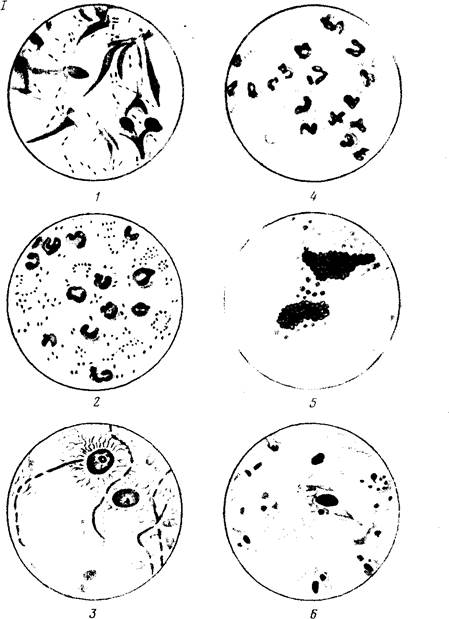 I - возбудитель туберкулеза птиц; 2 - возбудитель бруцеллеза; 3 - Vibrion septiqui; 4 - мытный стрептококк; 5 - актиномикозные друзы; 6 - тельца Ба- беша - Негри - student2.ru