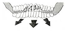 III. Движения нижней челюсти в трансверзальной плоскости. - student2.ru