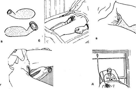III. Завершение процедуры. Все манипуляции с мочеприемником, так же как и с судном, должны проводиться в перчатках - student2.ru