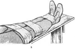 Иммобилизация нижней конечности - student2.ru