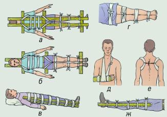иммобилизация, транспортировка пострадавших - student2.ru
