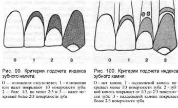 индексная оценка состояния тканей пародонта - student2.ru