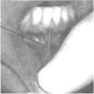 Инфильтрационная анестезия зубов под слизистую оболочку на нижней челюсти - student2.ru
