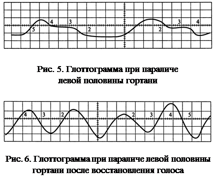 Инструментальное обследование голосового аппарата - student2.ru