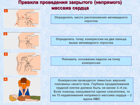 Искусственная вентиляция легких - student2.ru