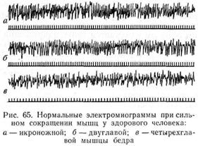 исследование функции нервно-мышечной системы - student2.ru