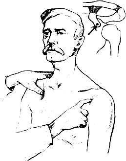 исследование плечевого пояса и плечевого сустава - student2.ru