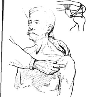 исследование плечевого пояса и плечевого сустава - student2.ru