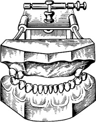 Изготовление зубных протезов - student2.ru