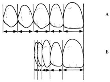 Изучение анатомического строения боковых зубов верхней челюсти. - student2.ru