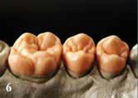 Изучение анатомического строения боковых зубов верхней челюсти. - student2.ru