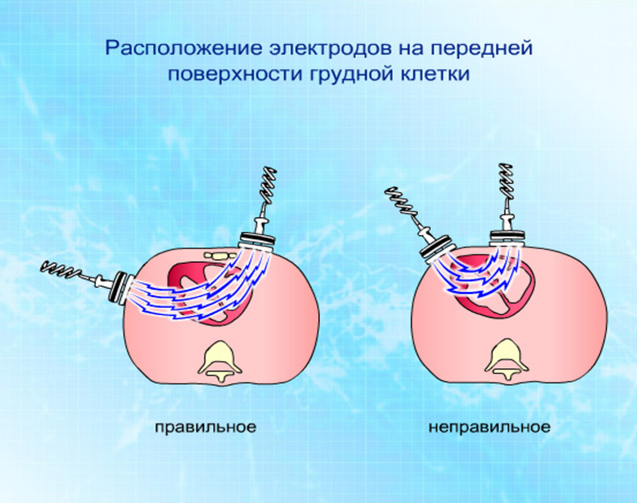 Кафедра анестезиологии и реаниматологии, медицины катастроф - student2.ru